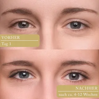 MORENA Wimpernserum Groeicomplex Lange Wimpers Getest — miniatuur 3