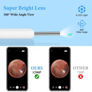 ACWOO Oorreiniger Camera IP67 Waterdicht WiFi 6 LED — miniatuur 4