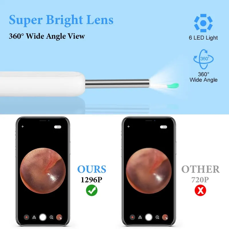 ACWOO Oorreiniger Camera IP67 Waterdicht WiFi 6 LED — foto 4
