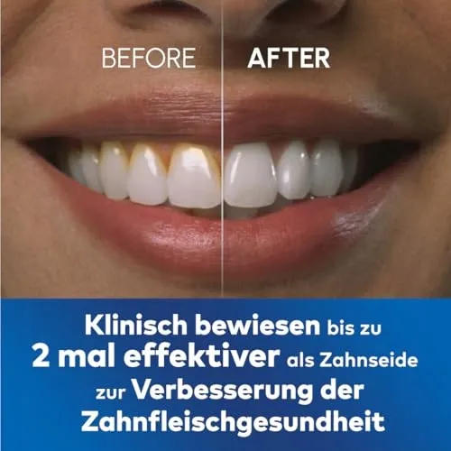 WATERPIK Ultra Professional Monddouche 7 Opzetstukken Blauw — foto 5