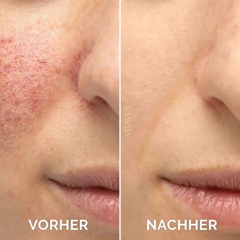 VITAYES Vitamine C Serum Hyaluronzuur 30ml Veganistisch — foto 2