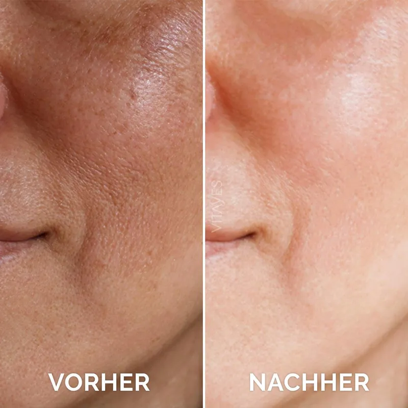 VITAYES Vitamine C Serum Hyaluronzuur 30ml Veganistisch — foto 4