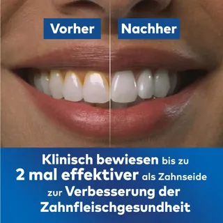 WATERPIK Cordless Advanced Waterflosser 4 Opzetstukken 3 Standen Wit — miniatuur 4