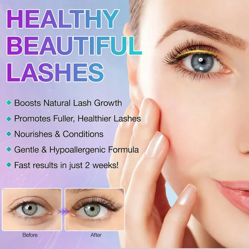 LONG4LASHES Wimperserum Groei Langer Dikker Sterker 5ml — foto 2