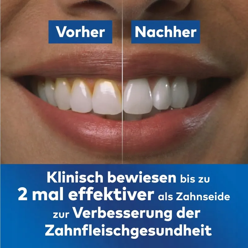 WATERPIK Cordless Advanced Waterflosser Draadloos 4 Opzetstukken Blauw — foto 5